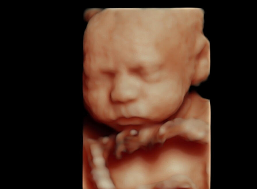 4d ultrasound scan